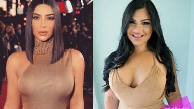 Fan de Kim Kardashian pagó 10 mil dólares para tener un trasero como el de ella (FOTOS)